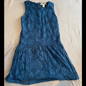 Forever 21 Lace Dress